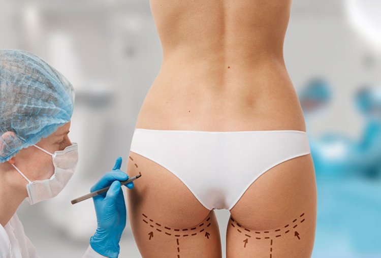 Why Experience Matters in Choosing a Surgeon for Butt Fat Transfer in Dubai